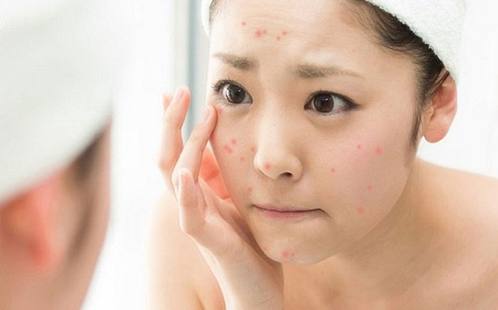 Nội tiết tố ảnh hưởng đến làn da của bạn như thế nào?