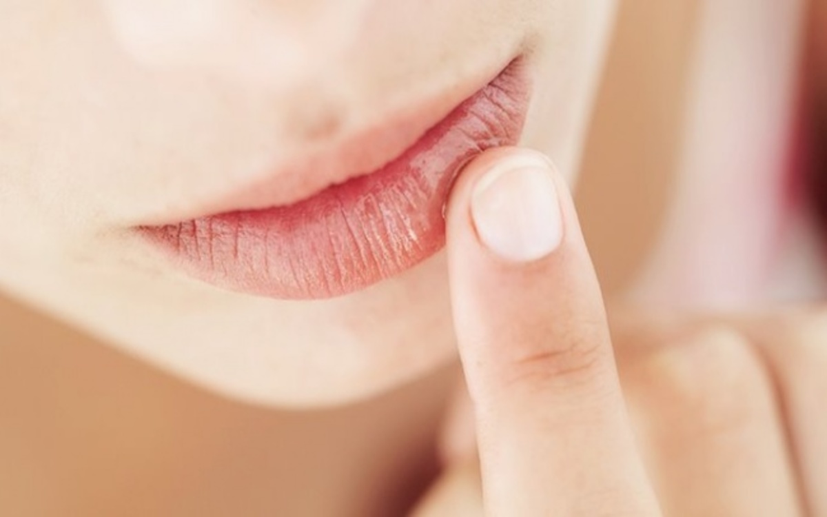Tại sao môi của bạn bị nứt nẻ - cách dưỡng môi bạn nên biết 1